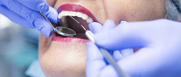 Best Emergency Dental Care for Sports Injuries in Winfield, WV