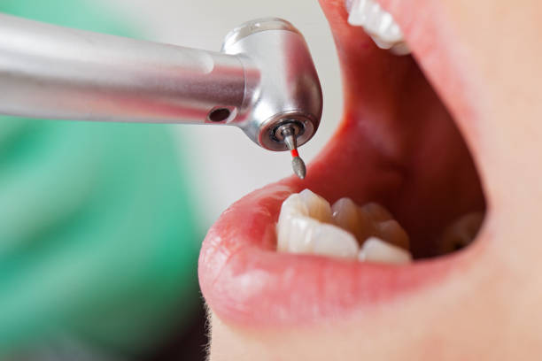 Best Walk-In Emergency Dental Services in Winfield, WV